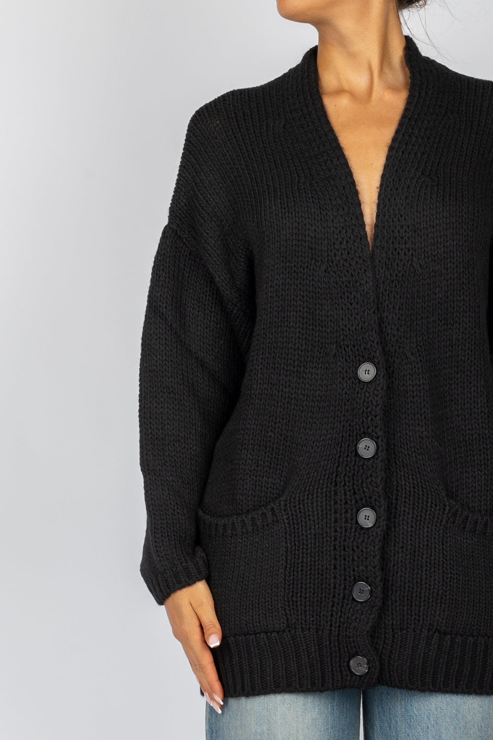 VICOLO - 33001S - CARDIGAN OVER CON BOTTONI